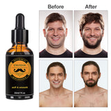 Beard Growth Kit For Men